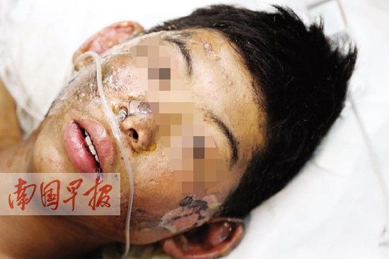 廣西:迎親車上20余萬(wàn)響鞭炮被引燃 5人被炸傷(圖)